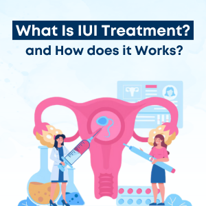 What Is Intrauterine Insemination (IUI) Treatment? and How does it Works?