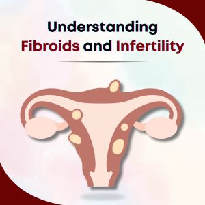 Understanding Fibroids and Infertility