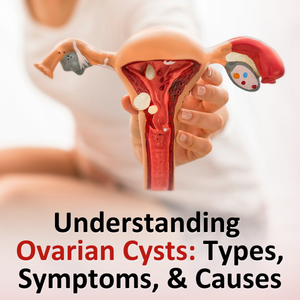 Understanding Ovarian Cysts: Types, Symptoms, and Causes