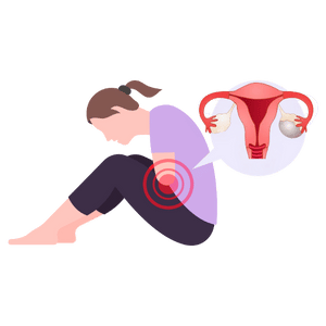 What is an Ovarian Cyst?