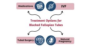 Treatment Options for Blocked Fallopian Tubes