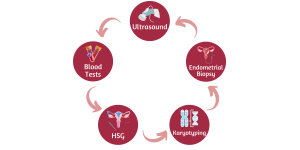 Diagnostic Tests for Recurrent Pregnancy Loss