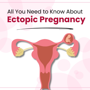 All You Need to Know About Ectopic Pregnancy