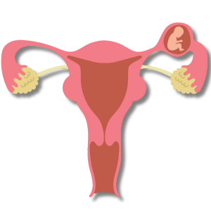 What Is an Ectopic Pregnancy?